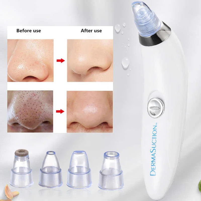 Derma Suction 3 In 1 Black Head Remover Machine | Acne Pimple Pore Cleaner Vacuum Suction Tool